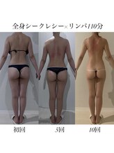 リブ シャルム(Lib Charm)/全身シークレシー10回