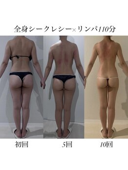 リブ シャルム(Lib Charm)/全身シークレシー10回