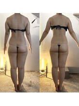 ヴェレン(Wellen)/ビフォーアフター