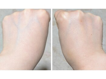 ミヤビ(miyabi)/ルネセル化粧品