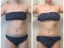 ニコルビー(Nicole Bee)/引き締め