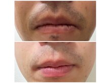 トトノエ プラス 新横浜店(TOTONOE+)の雰囲気（月1回のケアで印象が変わる。清潔感は習慣でつくれる/B&A3回目）