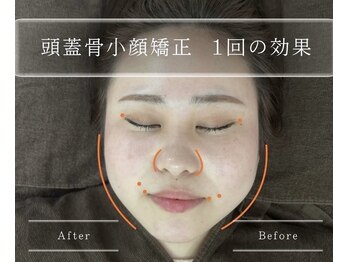 ノウ(NOU.)/沖縄ヘッドスパ／沖縄小顔矯正