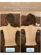 トータルボディケア サニー(TOTAL BODY CARE)/ブライダルエステ・肩甲骨を出す