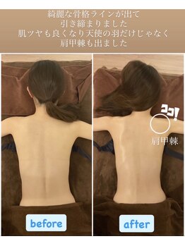 トータルボディケア サニー(TOTAL BODY CARE)/ブライダルエステ・肩甲骨を出す