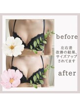アリサナ(Arisana)/「左右差改善でサイズも変わった