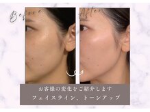 王子溝田橋整骨院 整体院の雰囲気（《美容鍼スタート》6月モニター様募集！残り3枠となります！）