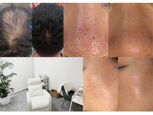 ベレア(BELEA)の雰囲気（プロセルセラピーズ★育毛/頭皮ケア/凹凸肌/毛穴/頭皮/脱毛/新宿）