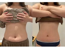 フォルチェ 春日(Folche)/ぽっこりお腹/くびれ/腰