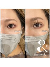 シェリ ザ ビューティー(Cheri the beauty)/アンドヘルシー