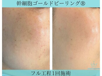 リメイククリニカルビューティー(Remake clinical beauty)/あなたの毛穴の目立つ原因