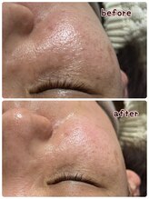 ケースタイル(k.style)/ブラックカーボンフォト