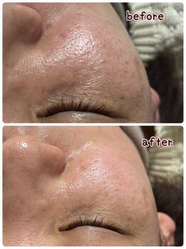 ケースタイル(k.style)/ブラックカーボンフォト