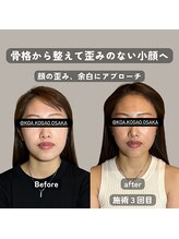 コア 心斎橋 堀江店(koa)/お客様ビフォーアフター！！