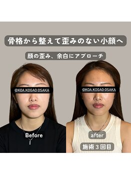 コア 心斎橋 堀江店(koa)/お客様ビフォーアフター!!