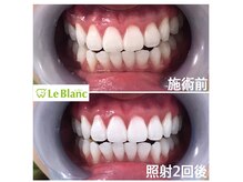 ルブラン 奈良店(Le Blanc)/お客様のような