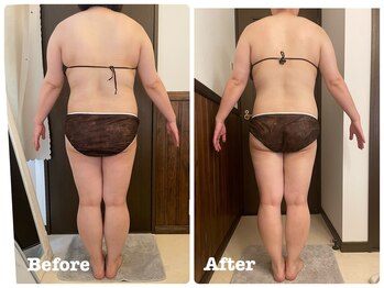 ナビ(NABI)/痩身×筋膜リリース