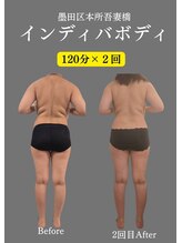 ハナヨサロン(hanayo salon)/大人気インディバ♪