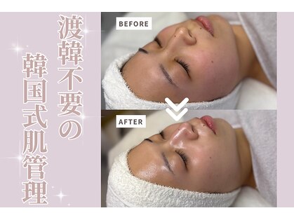 メルリー(Meruly)の写真