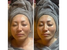 マイルーム(my room)/