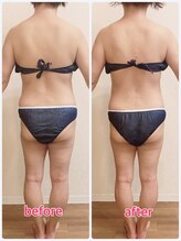 リナル 祐天寺店/120分☆痩身マシン＋全身リンパ