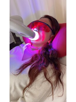 ペルラメディカルホワイトニング 名古屋/【初めての方にも】