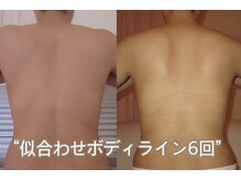 れふぇるん 足利店の雰囲気（ハミ肉・二の腕・背中！ボディラインも整える）