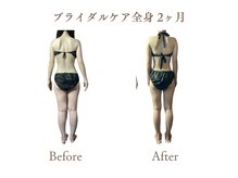 アダム(Adam)/全身360°美シルエット