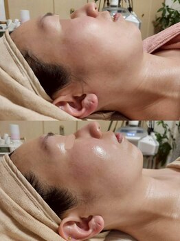 ロータスマップ(LOTUS MAP)/