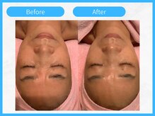 トウメイコガオ 横浜店/トウメイコガオ【ララピール】