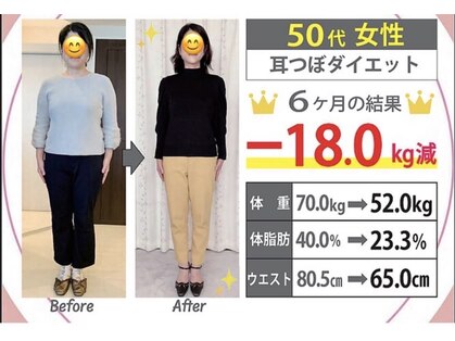 ボディスタイル(Body Style)の写真