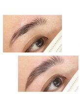 トータルビューティー ミヤビ(Miyabi)