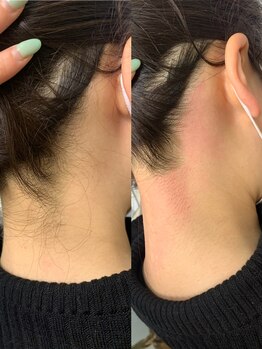 ラ フルール(La Fleur)/うなじワックス