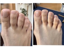 ヴィヴィル(VIVIL)/【爪磨き】艶やかな健康美爪に