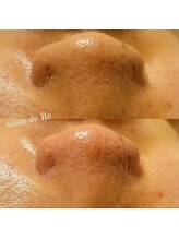 サロンドリー(salon de Re)/超音波エクストラクション