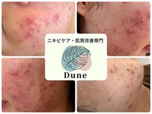 デューン 蕨店(Dune)