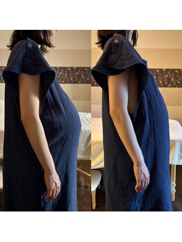 エッセンスマム 東京 プレナタールサロン(Prenatal salon)/背骨を調整してお腹小さく楽に！