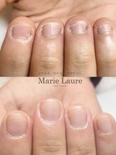 マリーロール 天王寺店(Marie Laure)/自爪育成/深爪矯正/ネイルケア