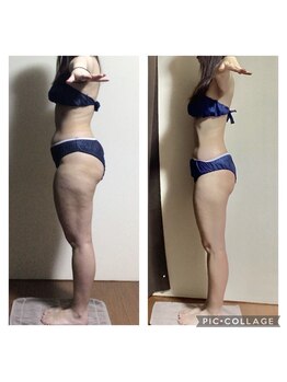 ビボディラボ 海老名店(美Body Labo)/セル脂肪