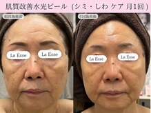 ラエッセ(La Esse)/70代でも美肌諦めない！