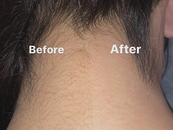 ハリウッドブロウリフトワクシー 渋谷(HOLLYWOODBROWLIFT WAXYYY.)/うなじワックス脱毛¥4,500