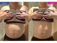 コリオ(KoRiO)/痩身5回目のお客様［狭山ヶ丘］