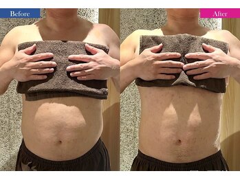 コリオ(KoRiO)/痩身5回目のお客様［狭山ヶ丘］