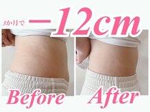 ラヴ 久屋大通店(Luv)/きらりさんBeforeAfter