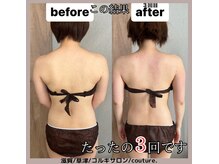クチュール(couture.)/3回目after