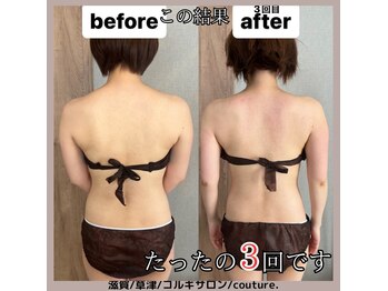 クチュール(couture.)/3回目after