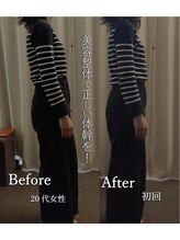 幸葉/整体/骨盤矯正/猫背矯正/小顔