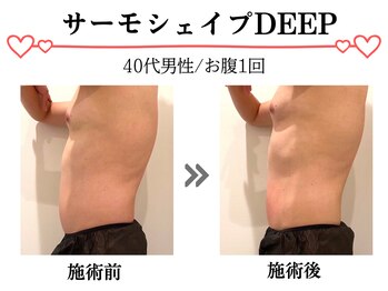 スパイア(SPIRE)/サーモシェィプDEEP★お腹