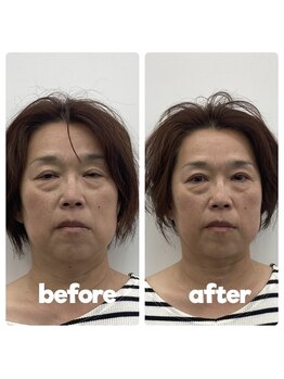 シャルム(CHARMEB)/目の開き一目瞭然！