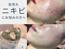 スワン 大阪南堀江(swan)の雰囲気（バリア機能が弱っている時に受けてほしい【LDM】【O2toDerm】）